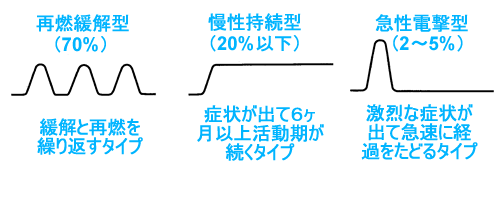 潰瘍性大腸炎